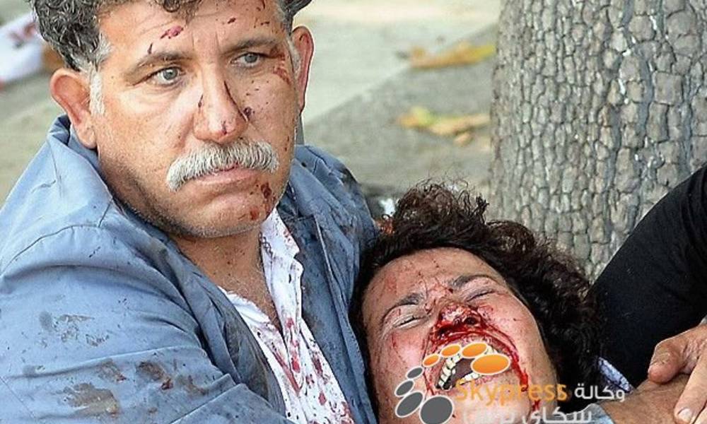 ارتفاع حصيلة تفجيري أنقرة إلى 95 قتيلا و246 جريحا وواشنطن تعلن تضامنها مع تركيا