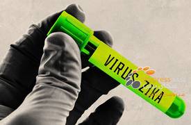 اليابان تسجل حالة إصابة ثانية بفيروس زيكا